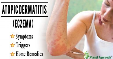 Atopic Dermatitis (Eczema) Symptoms, Triggers, and Home Remedies