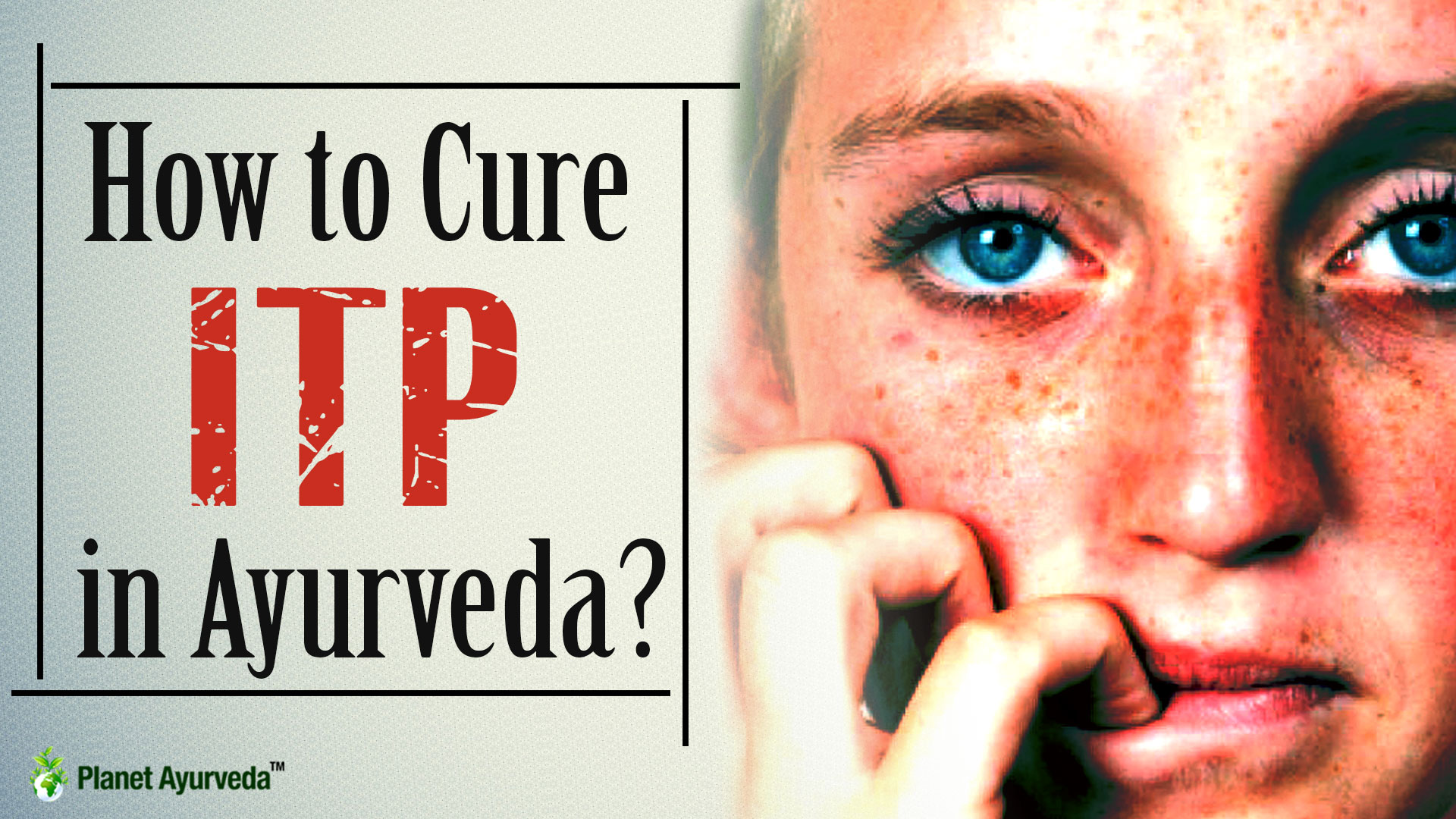 Cure ITP in Ayurveda