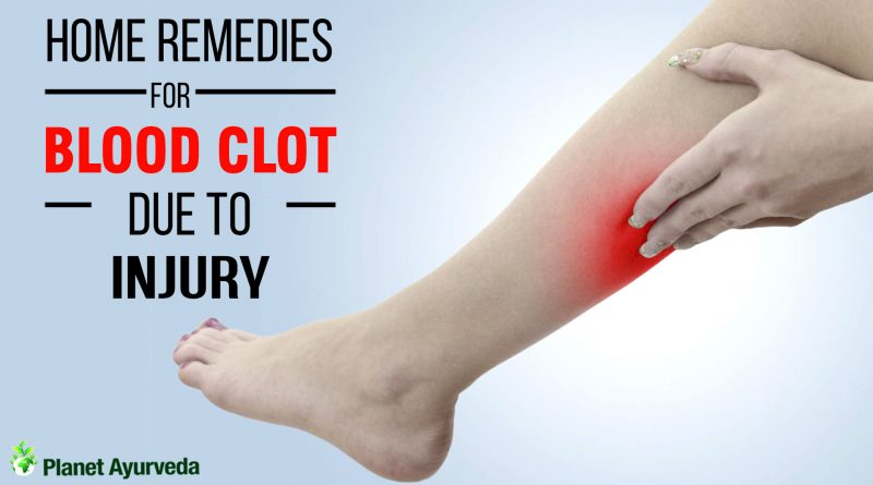 Prevent Clotting Of Blood And Treat In Your Legs Archives Planet Ayurveda