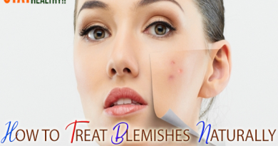 HOW TO TREAT BLEMISHES NATURALLY