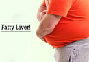 Alternative Medicines for Fatty Liver Cure