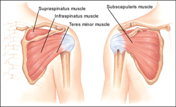 Shoulder Supraspinatus tendonitis 