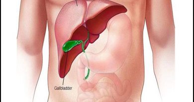 Liver Cirrhosis