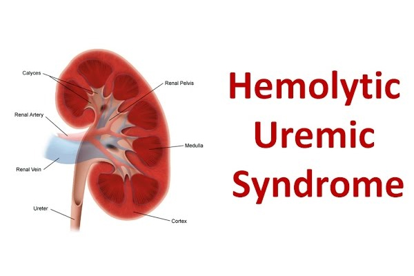 hemolytic–uremic syndrome