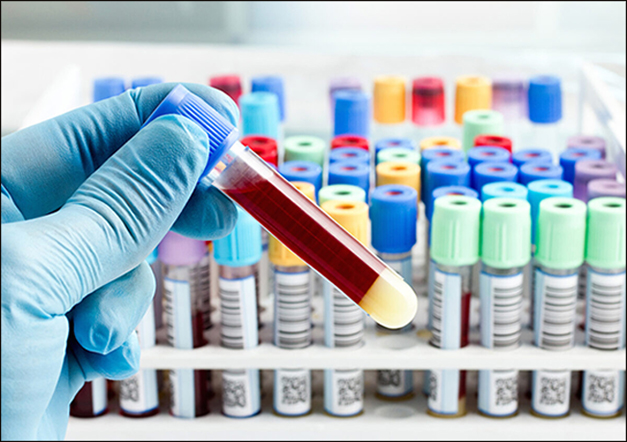 Creatine Phosphokinase Enzyme Test