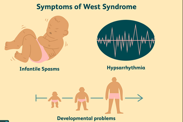 symptoms of west syndrome