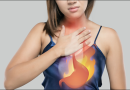 Gastroesophageal Reflux Disease