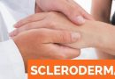 Scleroderma -Types, Symptoms, Diagnosis & Ayurvedic Treatment