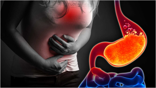 Gastroesophageal reflux disease (GERD)