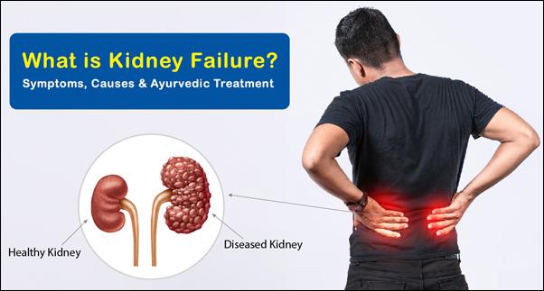 Kidney Failure, Treat Kidney Failure, Renal Failure, Causes of Kidney Failure, Signs and Symptoms, Investigations, Management, Ayurvedic view and Management, Herbal Remedies for Kidney Failure, Revive Kidneys Pack, Revive Kidneys Pack for Advance Stages, Kidney Disease